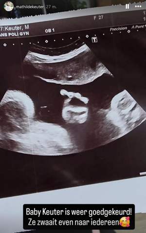 Mathilde Keuter baby echo Urk